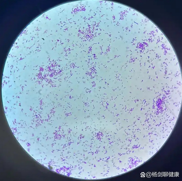 阴道加德纳菌